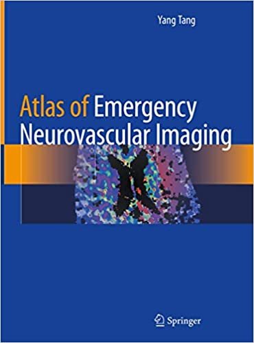 خرید کتاب اطلس آف ایمرجنسی نیوروواسکولار ایمیجینگ Atlas of Emergency Neurovascular Imaging2020
