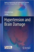 خرید کتاب هایپرتنشن اند برین دمیج Hypertension and Brain Damage, 1st Edition2016