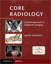 خرید کتاب کور رادیولوژی Core Radiology: A Visual Approach to Diagnostic Imaging 1st Edition 2013