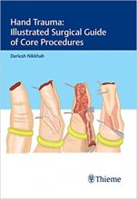 خرید کتاب هند تروما Hand Trauma: Illustrated Surgical Guide of Core Procedures