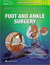 خرید کتاب هاسپیتال فور اسپشال سرجری Hospital for Special Surgery's Illustrated Tips and Tricks in Foot and Ankle Surgery