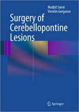 خرید کتاب Surgery of Cerebellopontine Lesions2013