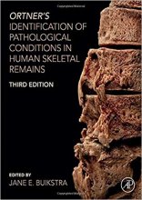 خرید کتاب اورتنرز ایدنتیفیکیشن آف پاتولوژیکال Ortner's Identification of Pathological Conditions in Human Skeletal Remains