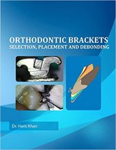 خرید Orthodontic Brackets: Selection,Placement and Debonding