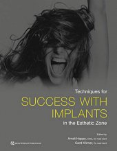 خرید Techniques for Success With Implants in the Esthetic Zone