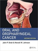 خرید Oral and Oropharyngeal Cancer 2nd Edition