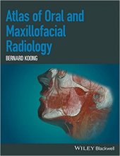 خرید Atlas of Oral and Maxillofacial Radiology 1st Edition