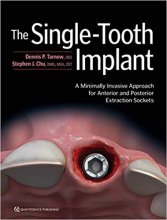 خرید The Single-Tooth Implant 1st Edition