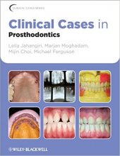 خرید Clinical Cases in Prosthodontics 1st Edition