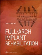 خرید Full-Arch Implant Rehabilitation 1st Edition