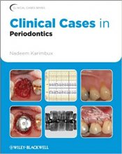 خرید Clinical Cases in Periodontics 1st Edition