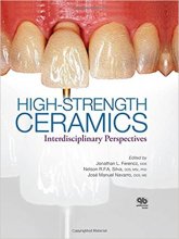خرید High-Strength Ceramics 1st Edition
