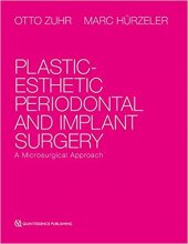 خرید Plastic-Esthetic Periodontal and Implant Surgery