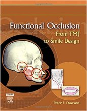 خرید Functional Occlusion: From TMJ to Smile Design