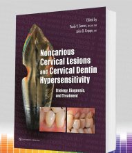 خرید Noncarious Cervical Lesions and Cervical Dentin Hypersensitivity
