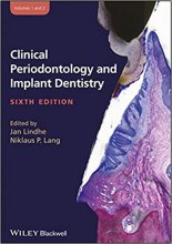 خرید Clinical Periodontology and Implant Dentistry, 2 Volume Set 6th Edition