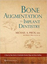 خرید کتاب بون اوگمنتیشن این ایمپلنت دنتیستری Bone Augmentation in Implant Dentistry: A Step-by-Step Guide to Predictable Alveola