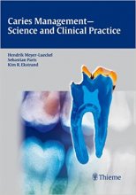 خرید Caries Management – Science and Clinical Practice 1st Edition