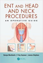 خرید ENT and Head and Neck Procedures: An Operative Guide