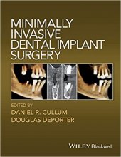 خرید Minimally Invasive Dental Implant Surgery, 1st Edition