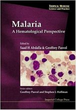 خرید Malaria: A Hematological Perspective: A Hematological Perspective