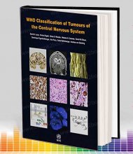 خرید WHO Classification of Tumours of the Central Nervous System, 4th Edition