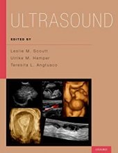 خرید کتاب آلتراسوند Ultrasound