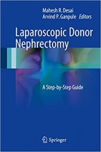 خرید کتاب لاپراسکوپیک دونور نفرکتومی Laparoscopic Donor Nephrectomy : A Step-by-Step Guide