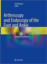 خرید کتاب آرتروزکوپی اند آندوسکوپی Arthroscopy and Endoscopy of the Foot and Ankle : Principle and Practice