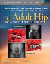 خرید کتاب آدولت هیپ The Adult Hip (Two Volume Set) : Hip Arthroplasty Surgery