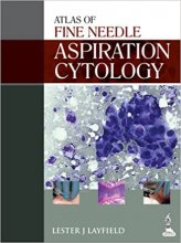 خرید کتاب آسپریشن سایتولوژی Atlas of Fine Needle Aspiration Cytology