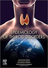 خرید کتاب اپیدمیولوژی آف تیروئید دیسوردرس Epidemiology of Thyroid Disorders 1st Edition