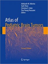 خرید کتاب اطلس آف پدیاتریک برین تومورز Atlas of Pediatric Brain Tumors, 2nd Edition2016