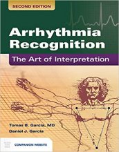 خرید کتاب آریتمی ریکوگنیشن Arrhythmia Recognition: The Art of Interpretation 2nd Edition2019